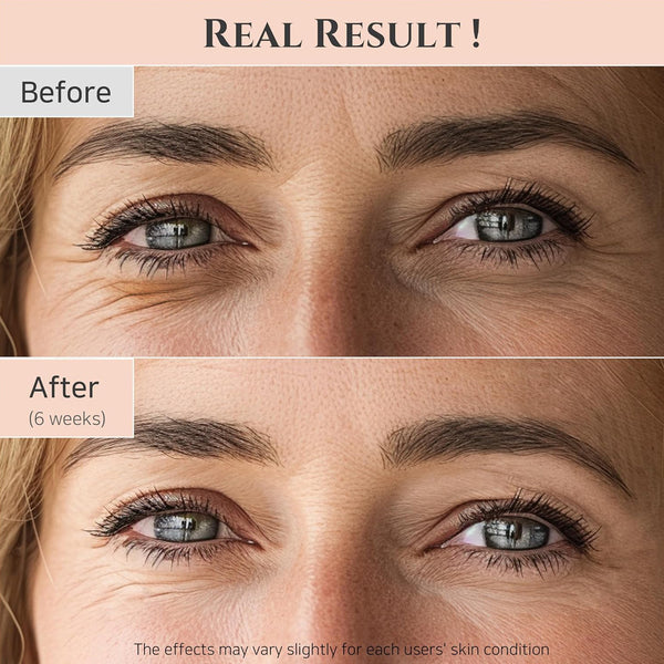 Revive Eye Serum : Ginseng + Retinal