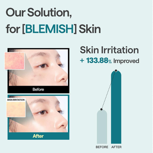Madecassoside Essential Mask Blemish Repair