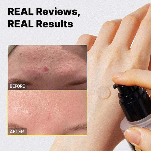 Advanced Snail 96 Mucin Power Essence